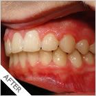 Smiling Wide Orthodontics - thumb 7