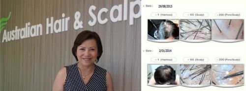 Australian Hair & Scalp Clinic - thumb 1