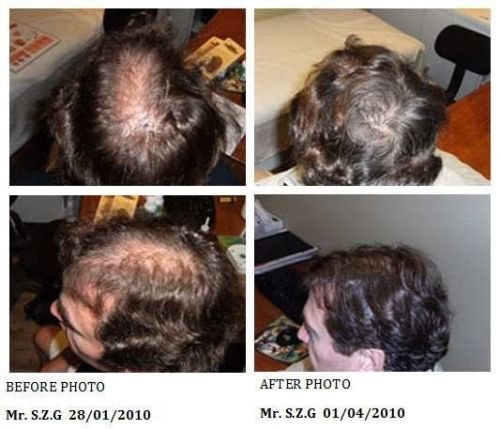 Australian Hair & Scalp Clinic - thumb 4