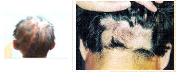 Australian Hair & Scalp Clinic - thumb 5