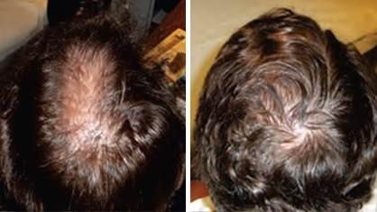 Australian Hair & Scalp Clinic - thumb 6