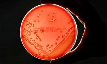 ‘Looming global health crisis’: urgent action needed to prevent spread of drug-resistant superbugs, CSIRO says
